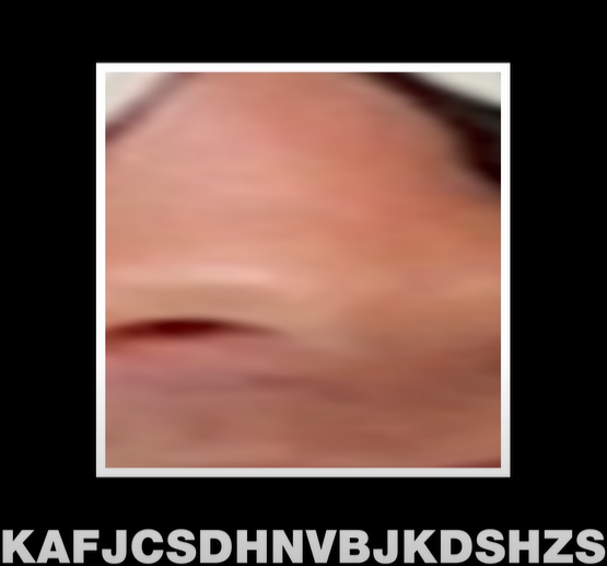 Ambrew Having A Stroke